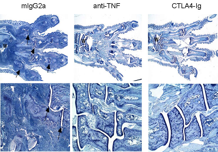 CIA Therapeutic treatment with anti-TNF and CTLA4-Ig – Histological analysis