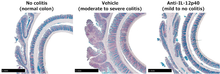 Colon histology (Alcian blue)