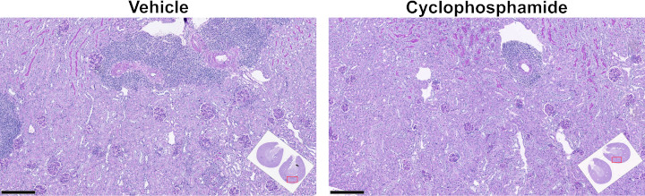 Illustrative images of Periodic acid-Schiff staining in kidneys