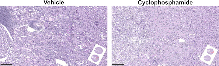 Illustrative images of Periodic acid-Schiff staining in kidneys