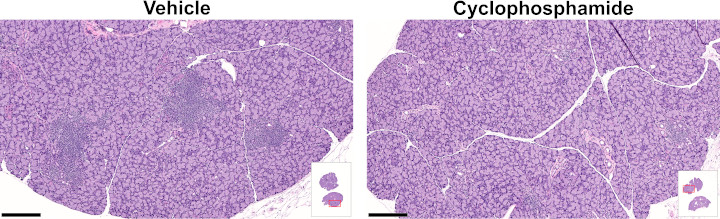 Lacrimal gland hematoxylin and eosin staining illustrative images